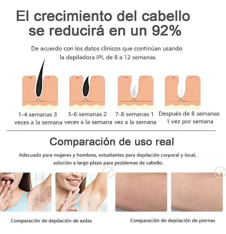 Depiladora Laser IPL Permanente